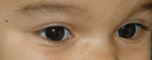 Kinder Augen (piqs.de ID: 9fcf4521d41d77f4c8bdb1dc9ad23d2c)